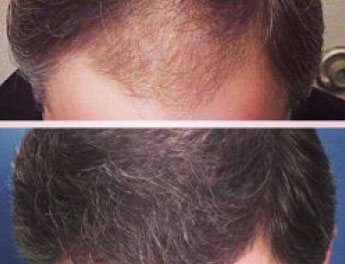 Review Our Before and After Archive